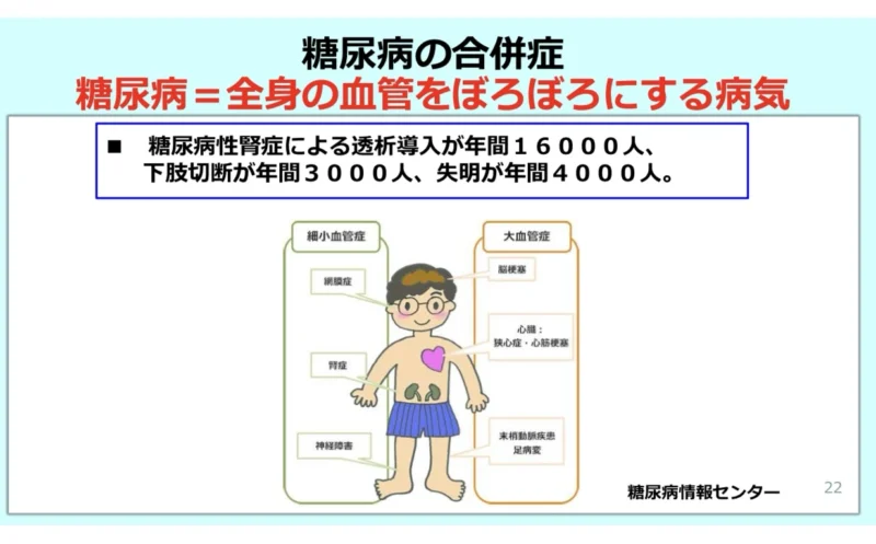 シメジとエノキで覚える!糖尿病が血管を壊す前に始める合併症予防ガイドのアイキャッチ画像
